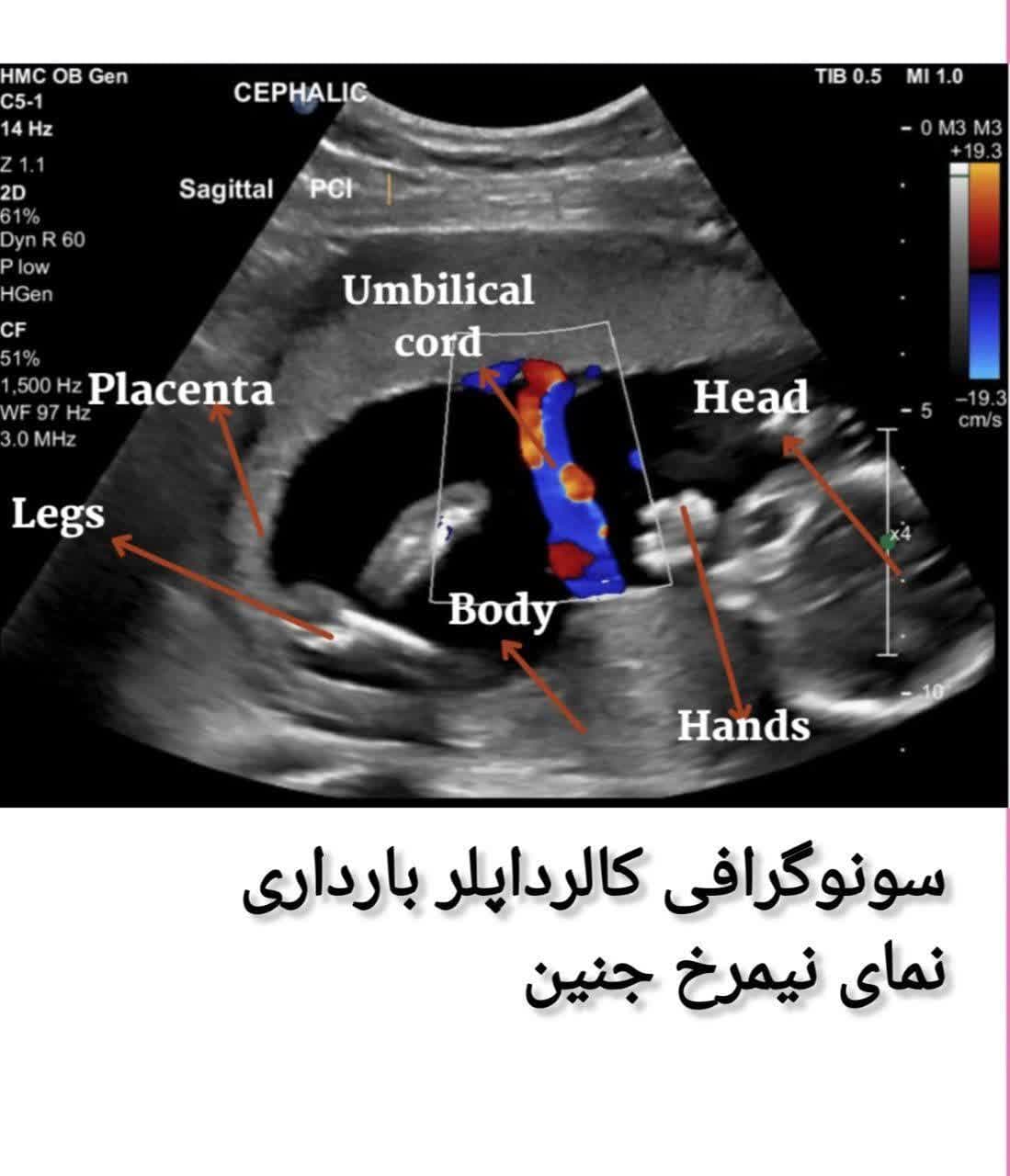 سونوگرافی کالرداپلر